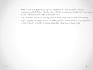o Help T cell are activated by the receptor of HLA- on its surfaceⅡ
combing with HBsAg, HBcAg and HLA- antigen on the B cells promoteⅡ
B cell to release anti-HBs and clear HBV
o The representation of HBcAg on the liver cells may cause cytopethy
o High degree representation of HBsAg within liver cells but the secretion
is not enough lead to ground-glass-like change of liver cells
 