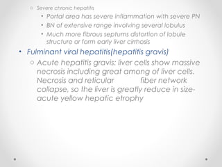 o Severe chronic hepatitis
• Portal area has severe inflammation with severe PN
• BN of extensive range involving several lobulus
• Much more fibrous septums distortion of lobule
structure or form early liver cirrhosis
• Fulminant viral hepatitis(hepatitis gravis)
o Acute hepatitis gravis: liver cells show massive
necrosis including great among of liver cells.
Necrosis and reticular fiber network
collapse, so the liver is greatly reduce in size-
acute yellow hepatic etrophy
 