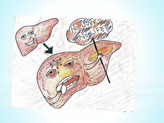Viral hepatitis
