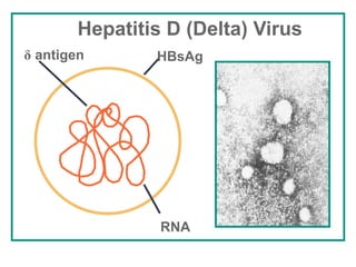 HBsAg
RNA
δ antigen
Hepatitis D (Delta) Virus
 
