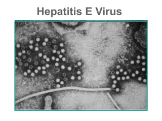 Hepatitis E Virus
 
