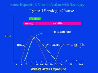Symptoms
HBeAg anti-HBe
Total anti-HBc
IgM anti-HBc anti-HBs
HBsAg
0 4 8 12 16 20 24 28 32 36 52 100
Acute Hepatitis B Virus Infection with Recovery
Typical Serologic Course
Weeks after Exposure
Titre
 