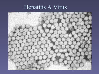 Hepatitis A Virus
 