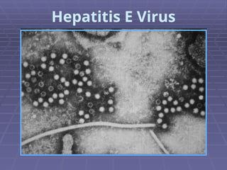Hepatitis E Virus
 