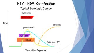anti-HBs
IgM anti-HDV
HDV RNA
HBsAg
HBV - HDV Coinfection
Typical Serologic Course
Symptoms
ALT Elevated
Titre
Total anti-HDV
Time after Exposure
 