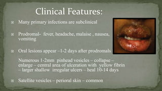  Many primary infections are subclinical
 Prodromal- fever, headache, malaise , nausea,
vomiting
 Oral lesions appear –1-2 days after prodromals
Numerous 1-2mm pinhead vesicles – collapse –
enlarge – central area of ulceration with yellow fibrin
– larger shallow irregular ulcers – heal 10-14 days
 Satellite vesicles – perioral skin – common
Clinical Features:
 