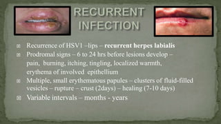  Recurrence of HSV1 –lips – recurrent herpes labialis
 Prodromal signs – 6 to 24 hrs before lesions develop –
pain, burning, itching, tingling, localized warmth,
erythema of involved epithellium
 Multiple, small erythematous papules – clusters of fluid-filled
vesicles – rupture – crust (2days) – healing (7-10 days)
 Variable intervals – months - years
 