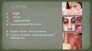  Cough
 Coryza
 C onjunctivitis
 Accompanied by fever
 Koplik’s Spots – buccal mucosa
 “Grains Of Salt In A Red Background”-
Pathognomic
 