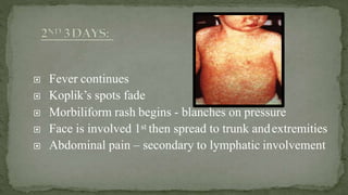  Fever continues
 Koplik’s spots fade
 Morbiliform rash begins - blanches on pressure
 Face is involved 1st then spread to trunk andextremities
 Abdominal pain – secondary to lymphatic involvement
 