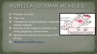  Primarily in winter
 Toga virus
 Transmission: droplet infection, congenital
rubella syndrome
 Infection of the mother by Rubella virus
during pregnancy can be serious
 Spontaneous abortion occurs in up to 20%
of cases
 "Blueberry muffin lesions."
 