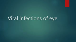 Viral infections of eye
 