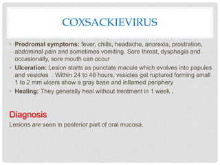 COXSACKIEVIRUS
• Prodromal symptoms: fever, chills, headache, anorexia, prostration,
abdominal pain and sometimes vomiting. Sore throat, dysphagia and
occasionally, sore mouth can occur
• Ulceration: Lesion starts as punctate macule which evolves into papules
and vesicles . Within 24 to 48 hours, vesicles get ruptured forming small
1 to 2 mm ulcers show a gray base and inflamed periphery
• Healing: They generally heal without treatment in 1 week .
Diagnosis
Lesions are seen in posterior part of oral mucosa.
 