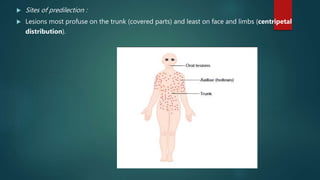 Viral infections | PPTX