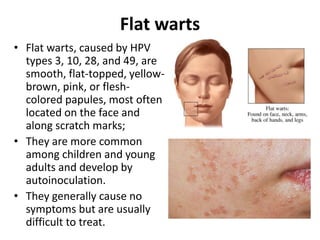 Viral infections.+pigmentation dis...pptx