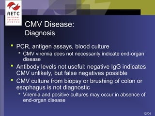 Presentation on Viral infections, etiology.ppt