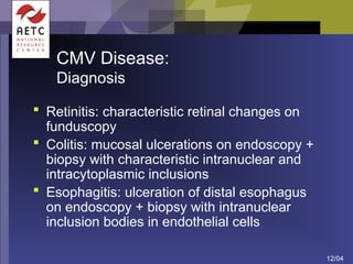 Presentation on Viral infections, etiology.ppt