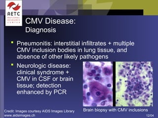 Presentation on Viral infections, etiology.ppt