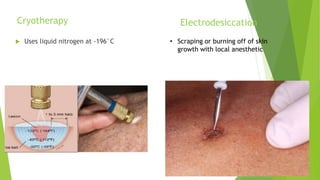 Cryotherapy
 Uses liquid nitrogen at -196°C
Electrodesiccation
• Scraping or burning off of skin
growth with local anesthetic
 