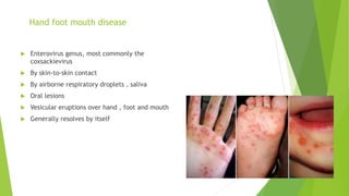 Hand foot mouth disease
 Enterovirus genus, most commonly the
coxsackievirus
 By skin-to-skin contact
 By airborne respiratory droplets , saliva
 Oral lesions
 Vesicular eruptions over hand , foot and mouth
 Generally resolves by itself
 