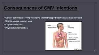 Viral infections in the oral cavity | PPTX