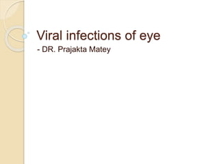 Viral infections of eye
- DR. Prajakta Matey
 