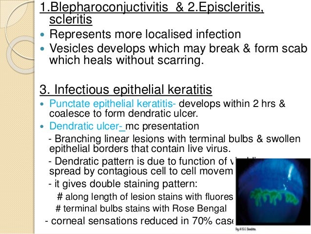 Are viral infections contagious