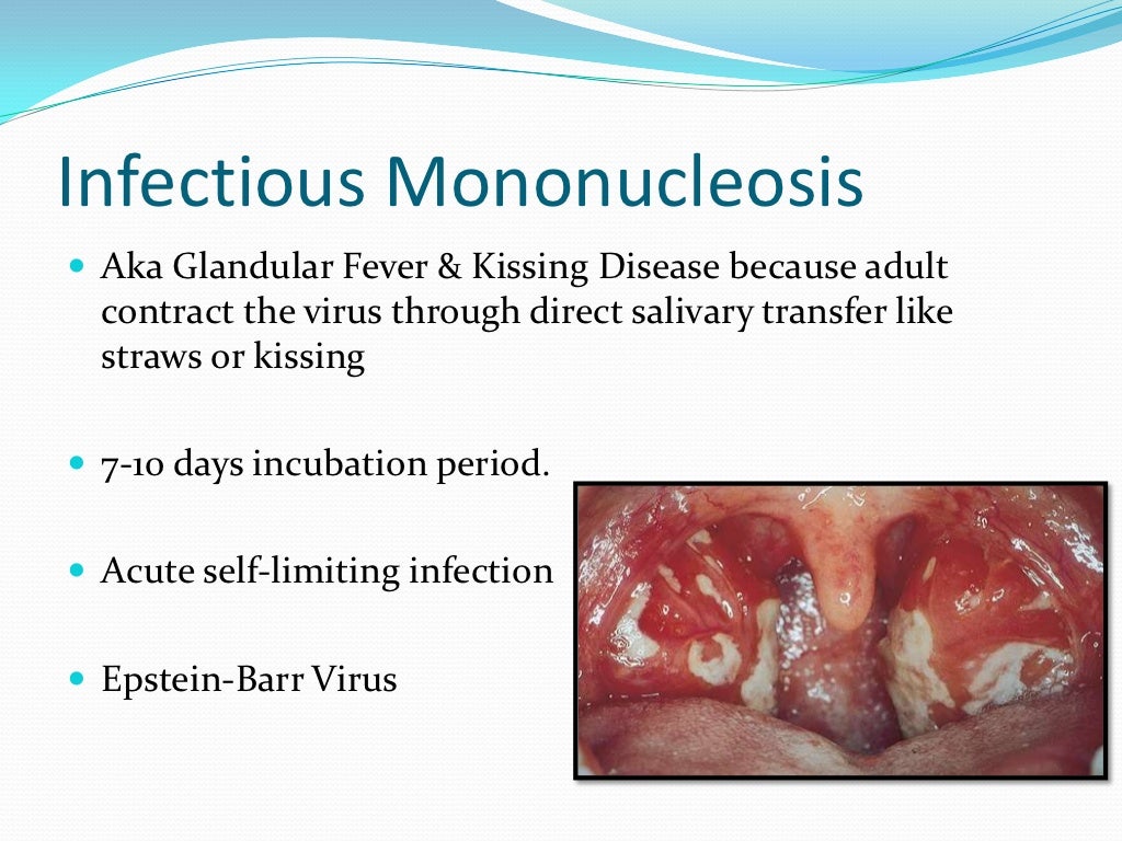Viral infections of oral cavity Dr. Abhishek Solanki