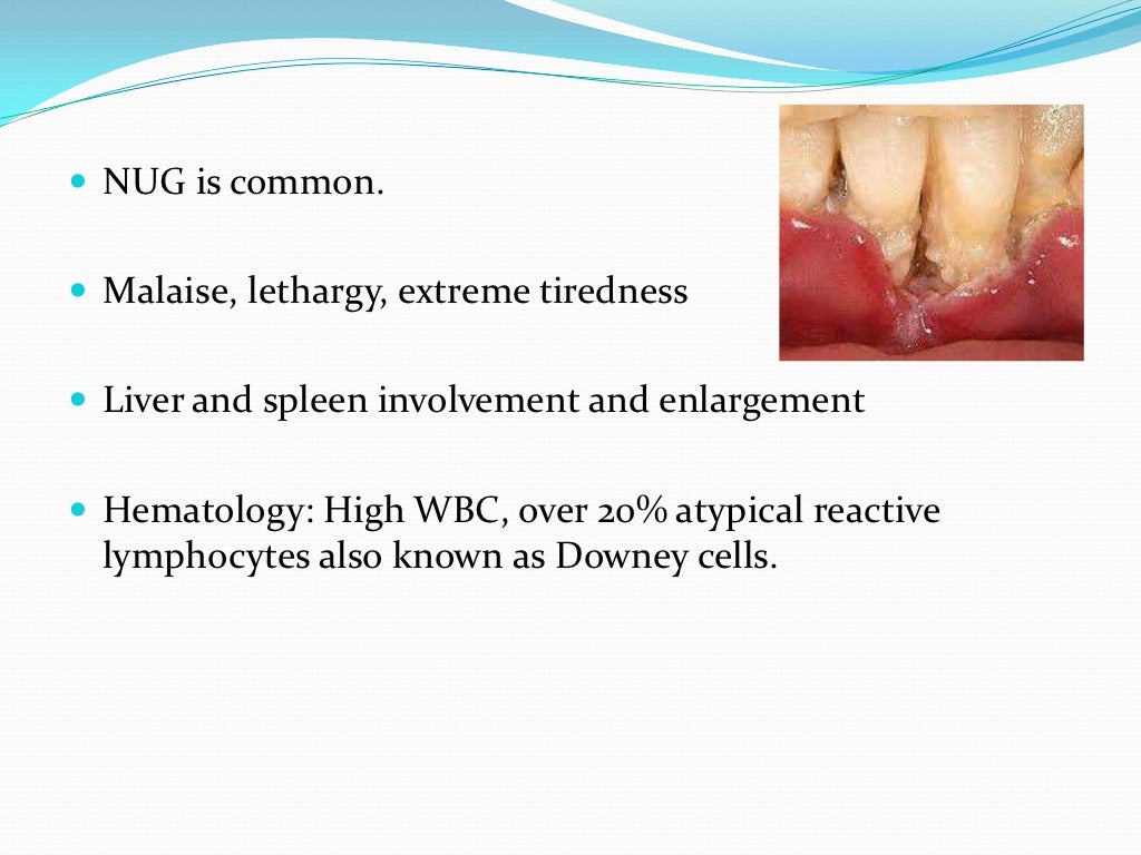 Viral infections of oral cavity - Dr. Abhishek Solanki