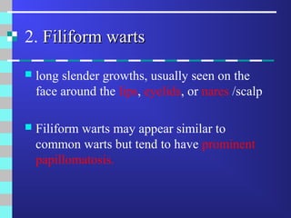 Filiform Style Viral infections-Human papillomaviruses infection | PPT