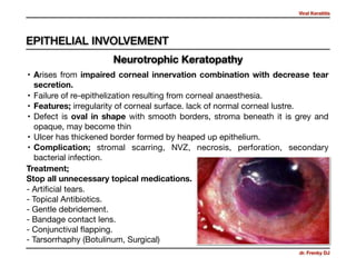 Viral Keratitis
dr. Frenky DJ
• Arises from impaired corneal innervation combination with decrease tear
secretion. 

• Failure of re-epithelization resulting from corneal anaesthesia.

• Features; irregularity of corneal surface. lack of normal corneal lustre.

• Defect is oval in shape with smooth borders, stroma beneath it is grey and
opaque, may become thin 

• Ulcer has thickened border formed by heaped up epithelium.

• Complication; stromal scarring, NVZ, necrosis, perforation, secondary
bacterial infection.
Treatment; 
Stop all unnecessary topical medications. 

- Artiﬁcial tears. 
- Topical Antibiotics. 
- Gentle debridement. 
- Bandage contact lens. 
- Conjunctival ﬂapping. 
- Tarsorrhaphy (Botulinum, Surgical)
Neurotrophic Keratopathy
EPITHELIAL INVOLVEMENT
 
