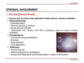 Viral Keratitis
dr. Frenky DJ
• Occurs due to active viral replication within stroma, immune mediated 

• Characterised by:  
- Epithelial defect. 
- Stromal necrosis & melting. 
- Dense stromal inﬁltrate. 
- Associated Ant. Uveitis with KP’s underlying areas of active stromal
inﬁltration. 

• Complications: 
- Corneal thinning & perforation. 

- Scarring  
- Vascularization 
- Lipid deposition.

• Treatment 

- Topical Antiviral 

- Topical antibiotics & cycloplegics. 
- Conjunctival ﬂapping & cyanoacrylate glue in cases of perforation.
STROMAL INVOLVEMENT
1. Necrotizing Stromal Keratitis
 