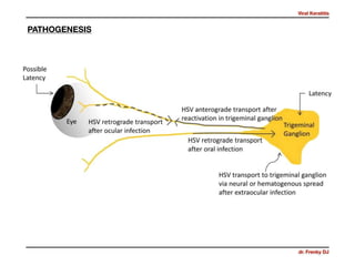 Viral Keratitis
dr. Frenky DJ
PATHOGENESIS
 