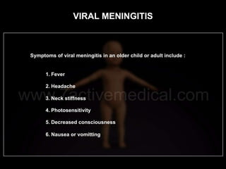 VIRAL MENINGITIS
 