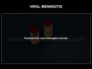 VIRAL MENINGITIS
 