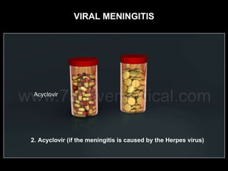 VIRAL MENINGITIS
 
