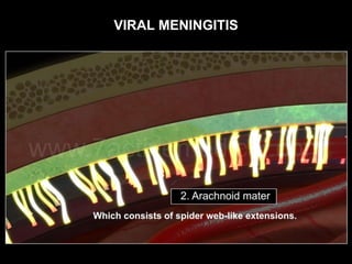 VIRAL MENINGITIS
 