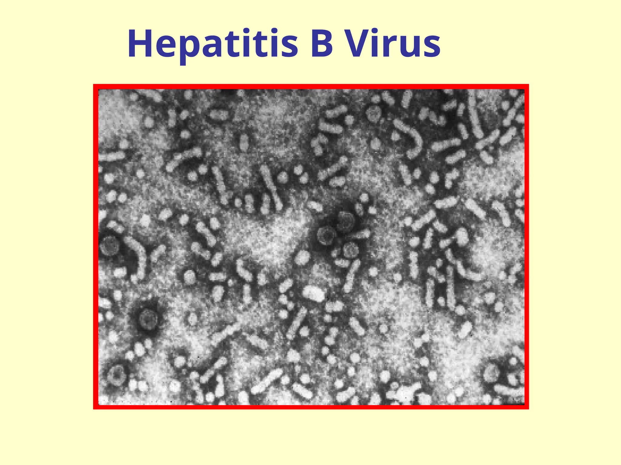 Hepatitis B Virus
 