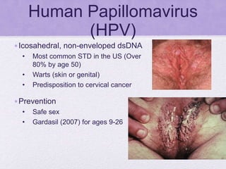 Human Papillomavirus
(HPV)
•Icosahedral, non-enveloped dsDNA
• Most common STD in the US (Over
80% by age 50)
• Warts (skin or genital)
• Predisposition to cervical cancer
•Prevention
• Safe sex
• Gardasil (2007) for ages 9-26
 