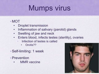 Mumps virus
•MOT
• Droplet transmission
• Inflammation of salivary (parotid) glands
• Swelling of jaw and neck
• Enters blood, infects testes (sterility), ovaries
• Infection of testes is called
• Orcitis??
•Self-limiting: 1 week
•Prevention
• MMR vaccine
 