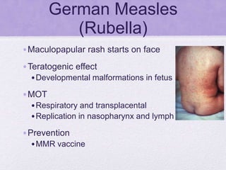 German Measles
(Rubella)
•Maculopapular rash starts on face
•Teratogenic effect
•Developmental malformations in fetus
•MOT
•Respiratory and transplacental
•Replication in nasopharynx and lymph nodes
•Prevention
•MMR vaccine
 