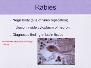 Rabies
 Negri body (site of virus replication)
 Inclusion inside cytoplasm of neuron
 Diagnostic finding in brain tissue
Only shown after death through
biopsy
 