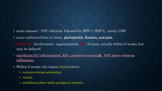 • most common - VZV infection, followed by HSV-1, HSV-2, rarely, CMV
• acute unilateral loss of vision, photophobia, floaters, and pain
• Fellow eye involvement - approximately 36% of cases, usually within 6 weeks, but
may be delayed
• significant AC inflammation, KPs, posterior synechiae, IOP, heavy vitreous
infiltration
• Within 2 weeks, the classic triad evolves
• occlusive retinal arteriolitis
• vitritis,
• multifocal yellow-white peripheral retinitis
 