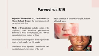 Parvovirus Hand Rash Comprehensive Overview of Viral Skin Infections in Children: Diagnosis ...