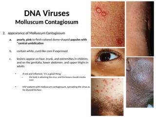 Viral Skin Infections Clinical Pathology Study Questions_Mari-Alina ...