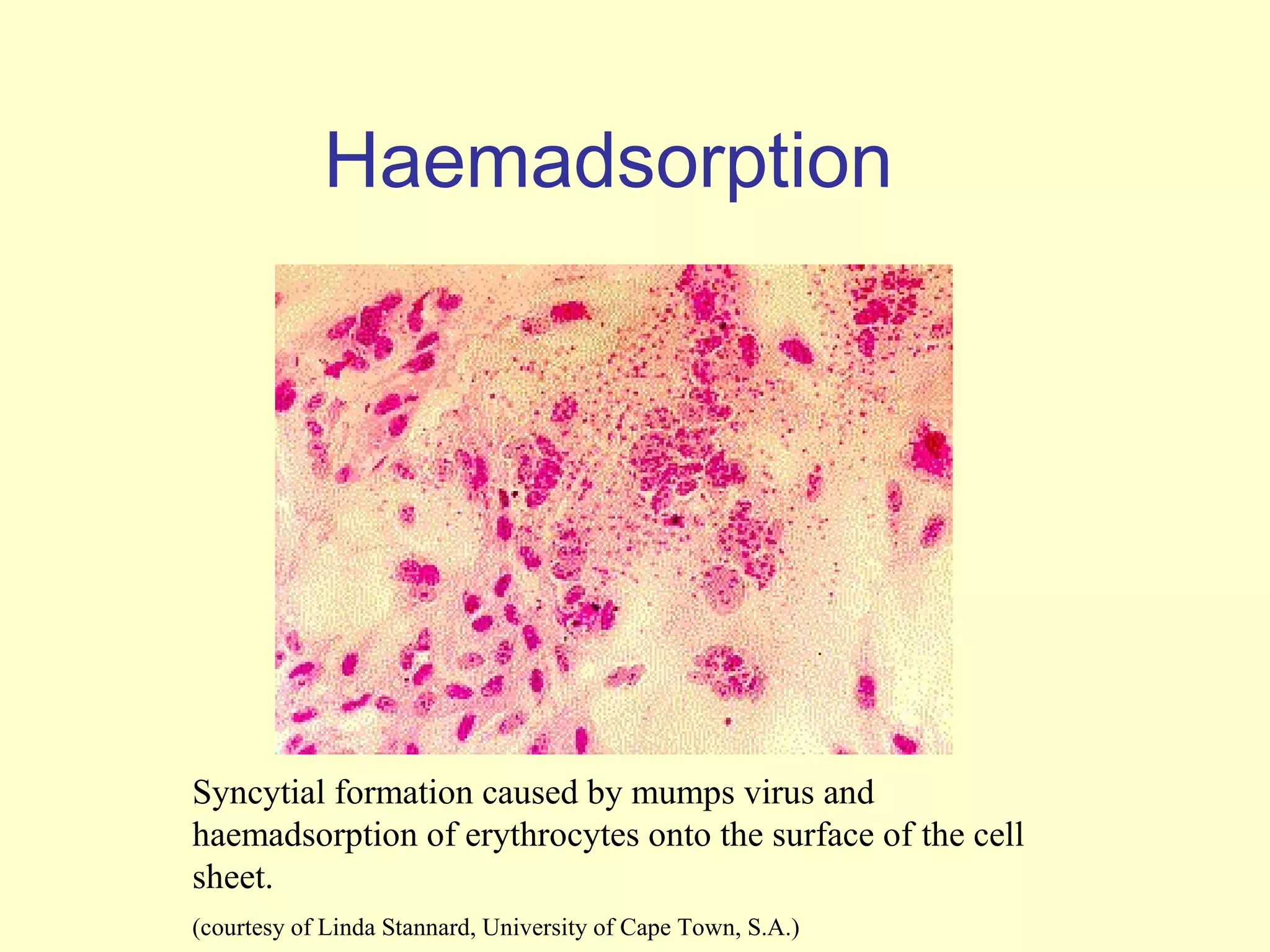 Haemadsorption




Syncytial formation caused by mumps virus and
haemadsorption of erythrocytes onto the surface of the cell
sheet.
(courtesy of Linda Stannard, University of Cape Town, S.A.)
 