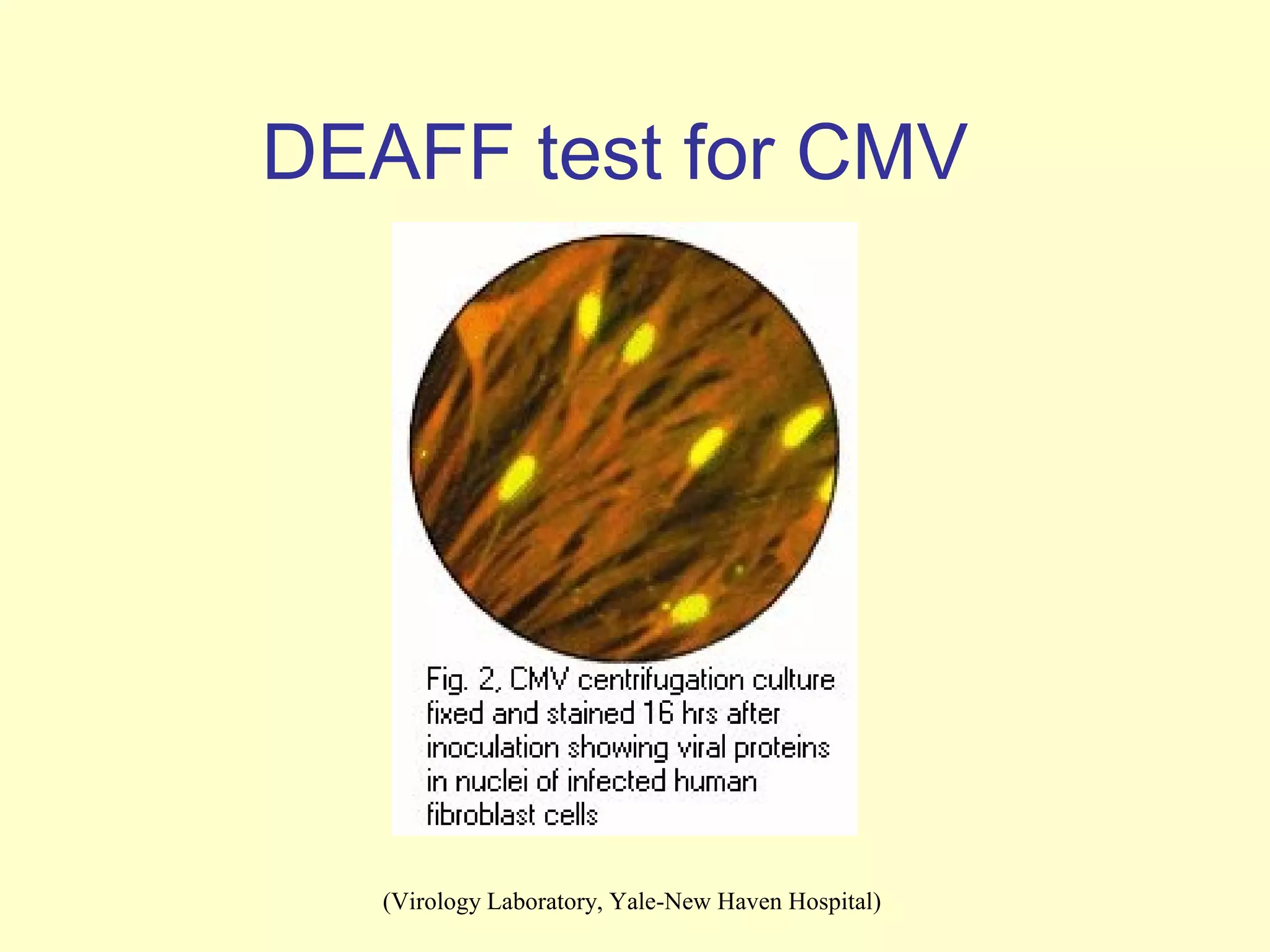 DEAFF test for CMV




   (Virology Laboratory, Yale-New Haven Hospital)
 