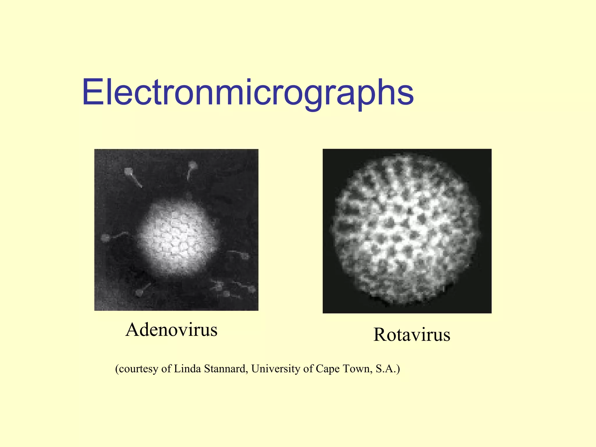 Electronmicrographs




   Adenovirus                                         Rotavirus
 (courtesy of Linda Stannard, University of Cape Town, S.A.)
 
