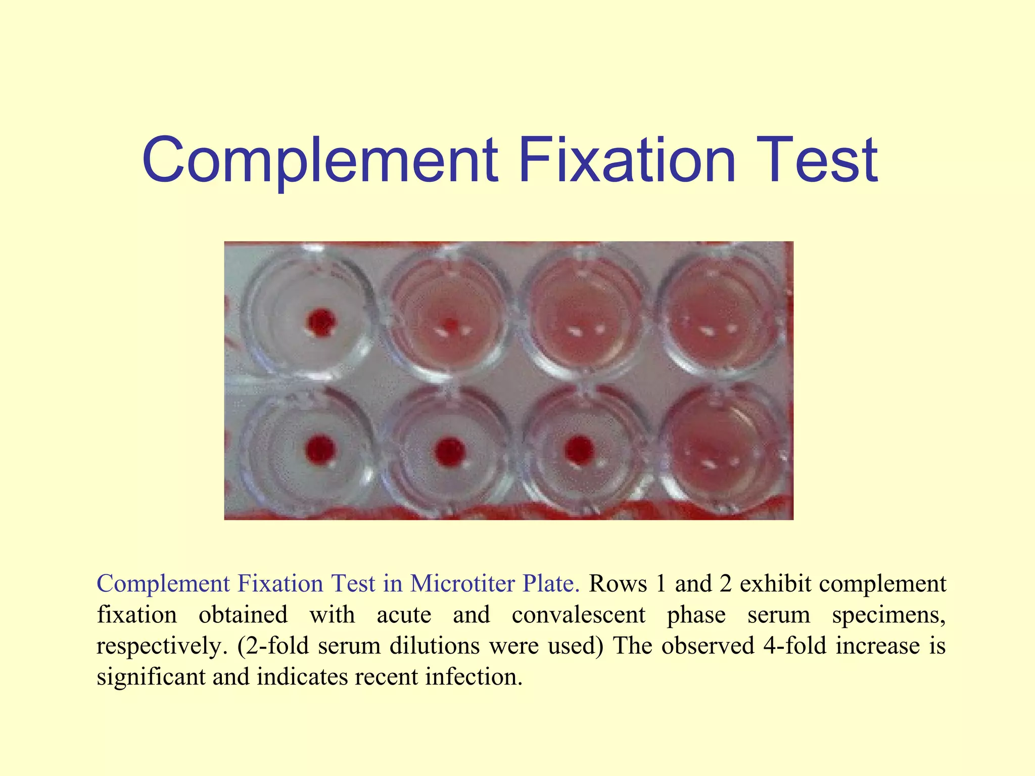 Complement Fixation Test




Complement Fixation Test in Microtiter Plate. Rows 1 and 2 exhibit complement
fixation obtained with acute and convalescent phase serum specimens,
respectively. (2-fold serum dilutions were used) The observed 4-fold increase is
significant and indicates recent infection.
 