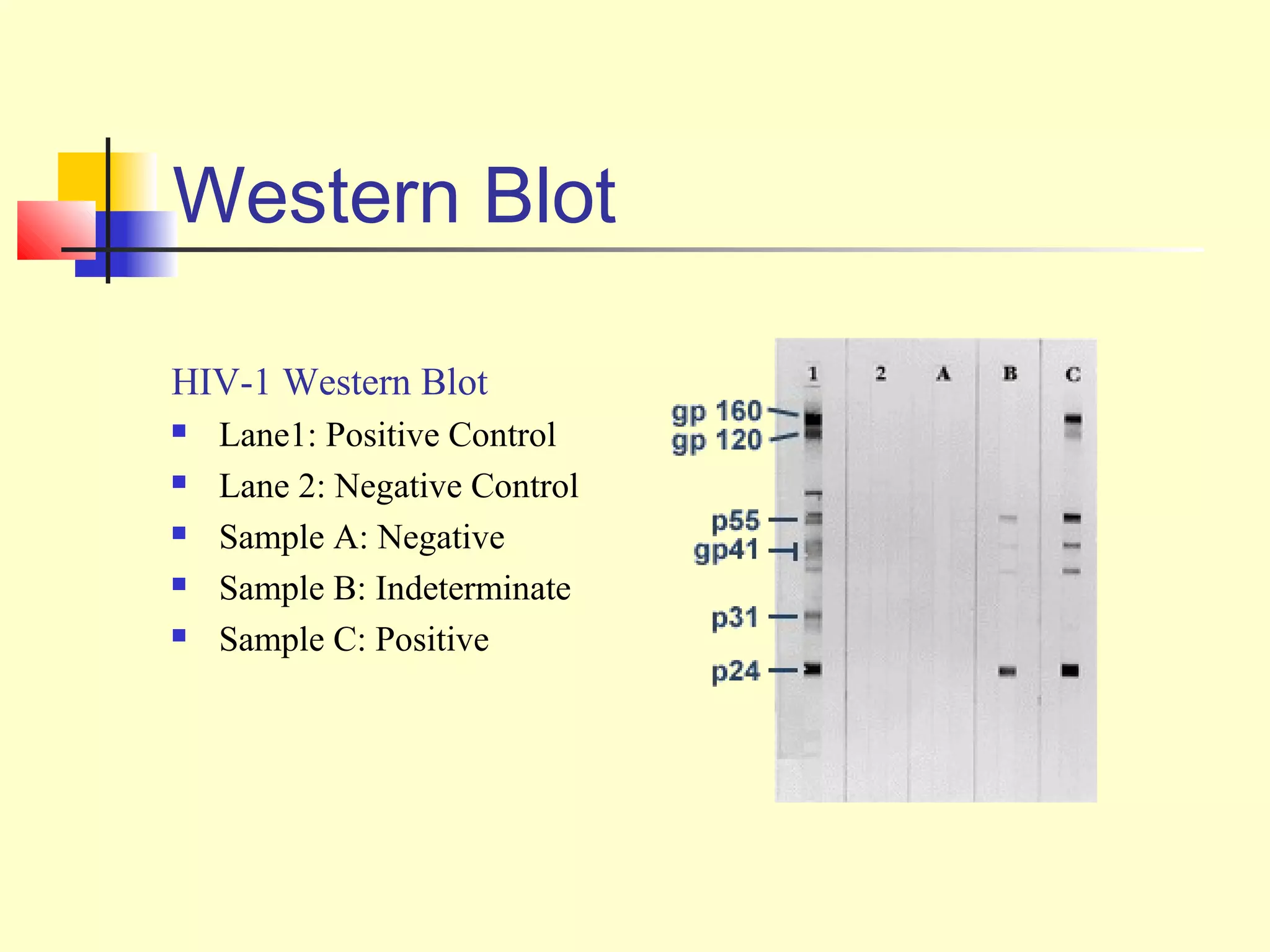 Western Blot

HIV-1 Western Blot
   Lane1: Positive Control
   Lane 2: Negative Control
   Sample A: Negative
   Sample B: Indeterminate
   Sample C: Positive
 