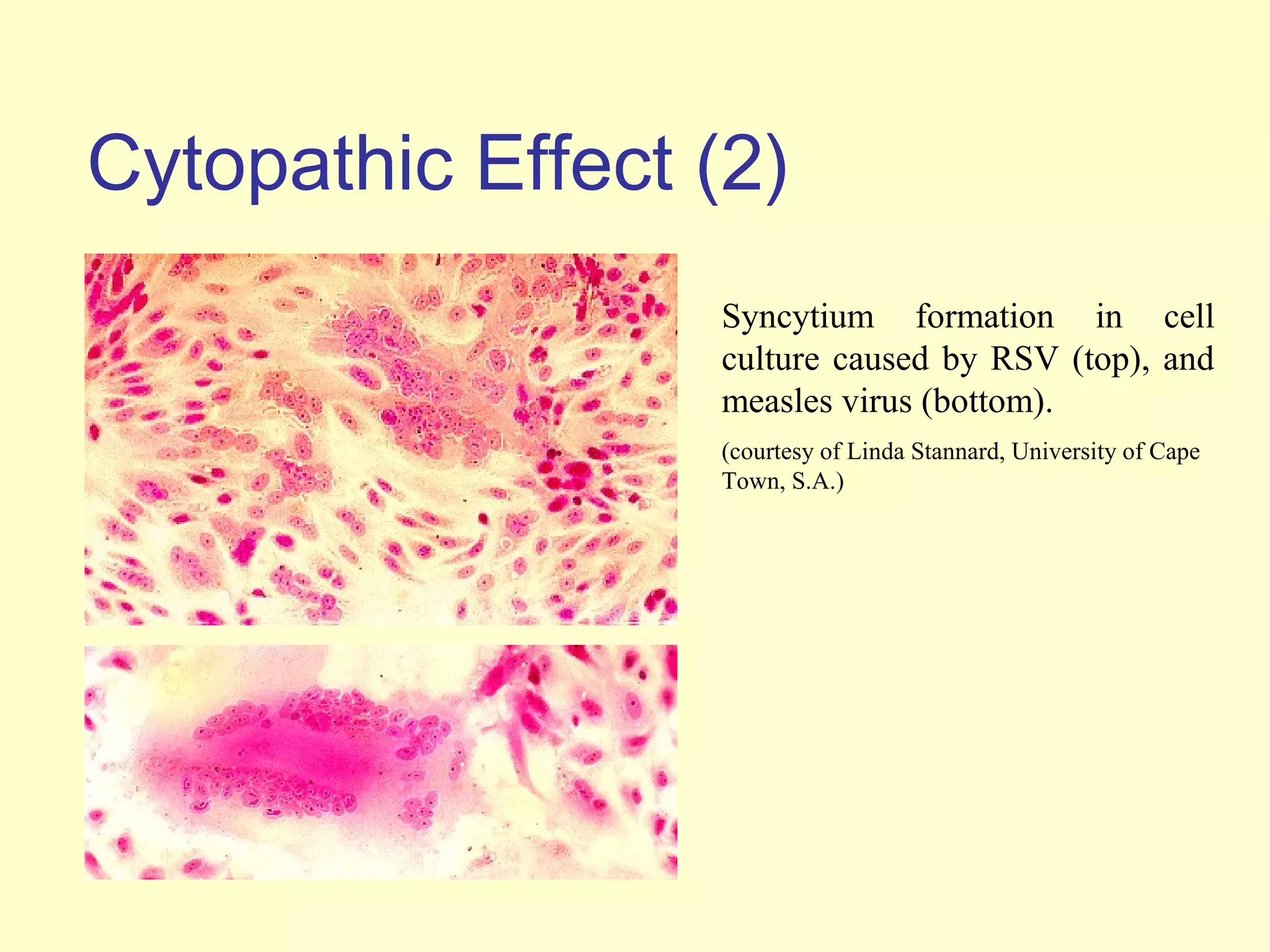 Cytopathic Effect (2)
                  Syncytium formation in cell
                  culture caused by RSV (top), and
                  measles virus (bottom).
                  (courtesy of Linda Stannard, University of Cape
                  Town, S.A.)
 